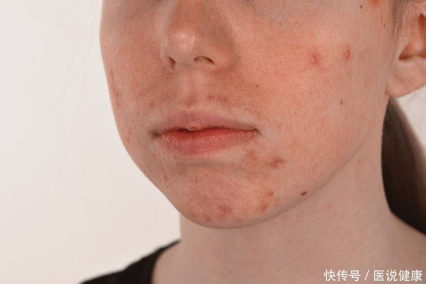 怎样护肤保养_护肤保养工具_护肤保养讲座