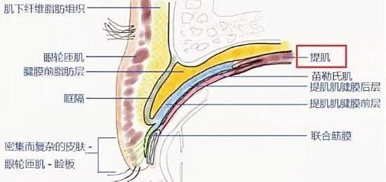 眼睛|双眼皮修复手术可以让眼睛变回初眼的样子吗？