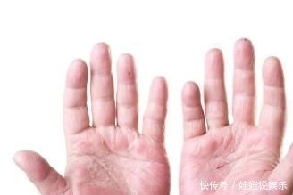 肝脏|肝脏的“救命良药”找到了， 早晚2杯，修复肝细胞，肝病不来！