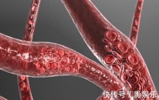 日常生活中|日本平均寿命高于我国,只因2种食物,而2种食物却产于我国!