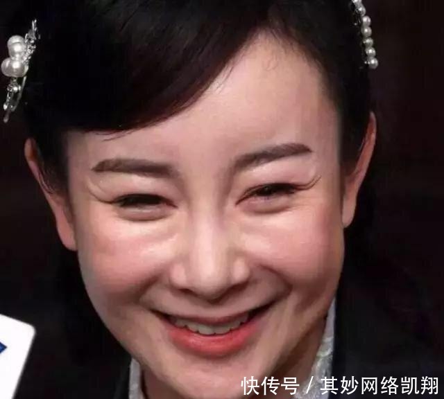 垮掉|明星都爱打玻尿酸, 但你一定没看过她们脸垮掉的样子