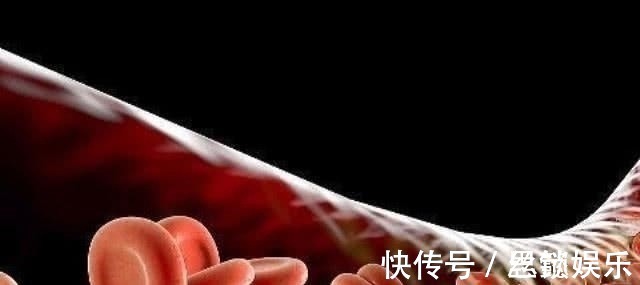 血栓|天然“阿司匹林”被找到了,每天吃一点,血管干净,远离高血脂!