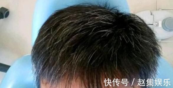 啤酒|民间一个土秘方，不管白发多严重，让你从此告别染发，了解一下