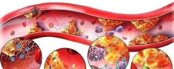 蓝莓|一旦查出高血压,难吃也要多吃“它”,增强血管弹性,血压更稳定