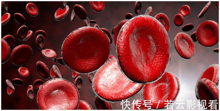 血脂异常|血脂高不高,看脸就知道,若没有这3个症状,恭喜血脂控制得不错