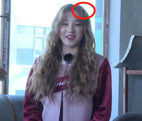 宋雨琦录跑男被抓拍,却意外带火头上的“神器”,专防发际线后退