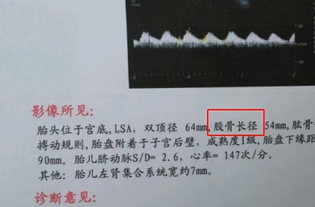 小家伙|胎宝出生“倒计时”一个月，身体有哪些变化？看过觉得他好努力