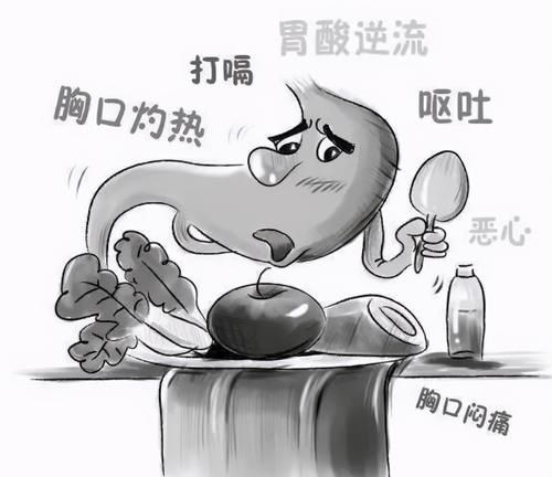 药物|治疗胃食管反流，这四种药一定要了解