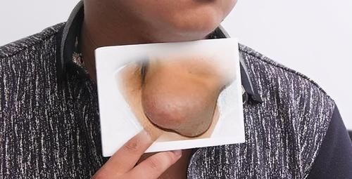 医生|癌症多长时间不复发，算是治愈了？医生给出3个标准，你达标没？