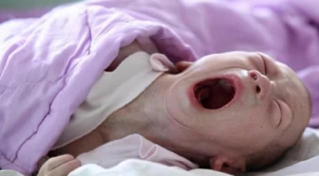 检查|四维检查宝宝畸形,孕妈却执意生下孩子,出生后全家“沸腾了”