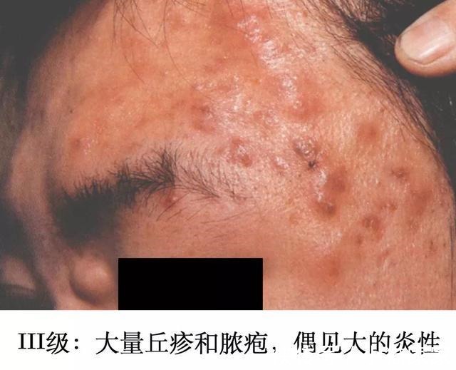 护肤品 哪些皮肤问题是护肤品不能解决的!