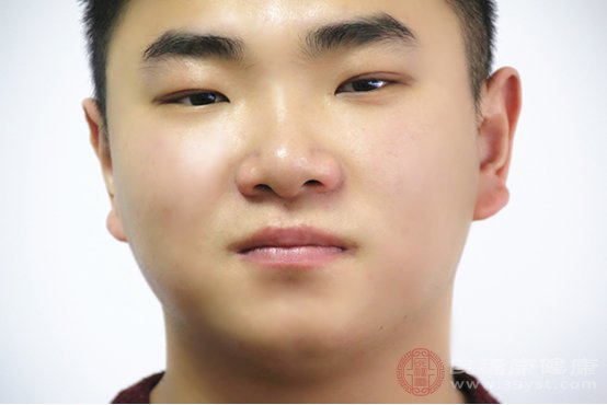 皮肤发黄是什么原因