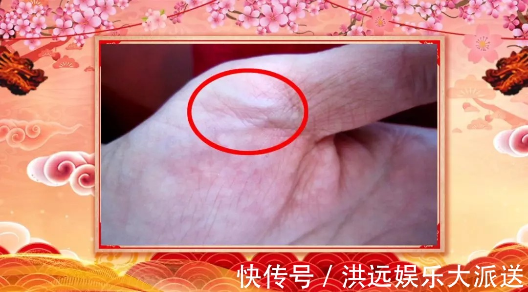 慢性心衰|身体好不好，看手就知道！这几处变化可能藏大病