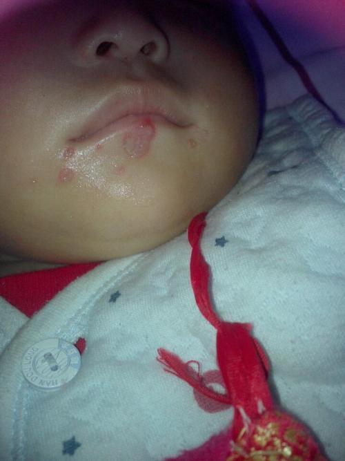 脐带|医院“黑脸宝宝”火了,宝妈耐心等待娃长大,长开后人人夸