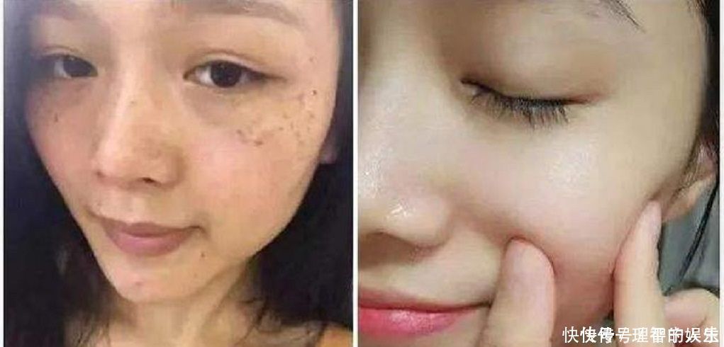 色斑妹子别乱花钱了,用酸奶加它敷脸,美白嫩肤又淡斑,值得收藏