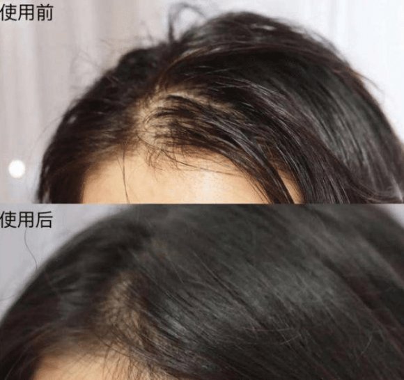 年轻人都“嫌弃”超市大牌洗发水，反倒追随小众新国货，这是为什么？