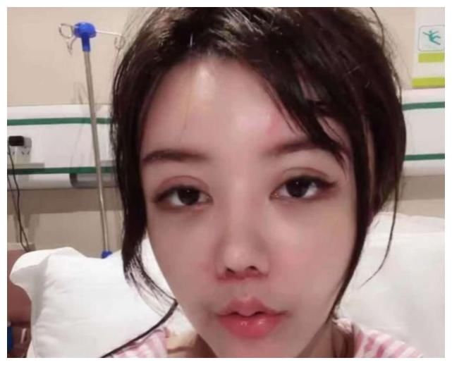 疤痕|韩安冉急于展示整容效果，蓬头垢面疤痕明显，为博关注下了手术就拍视频