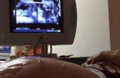 假性|怀孕8个月肚子突然“变硬”,孕妈哭的稀里哗啦,医生却无奈了