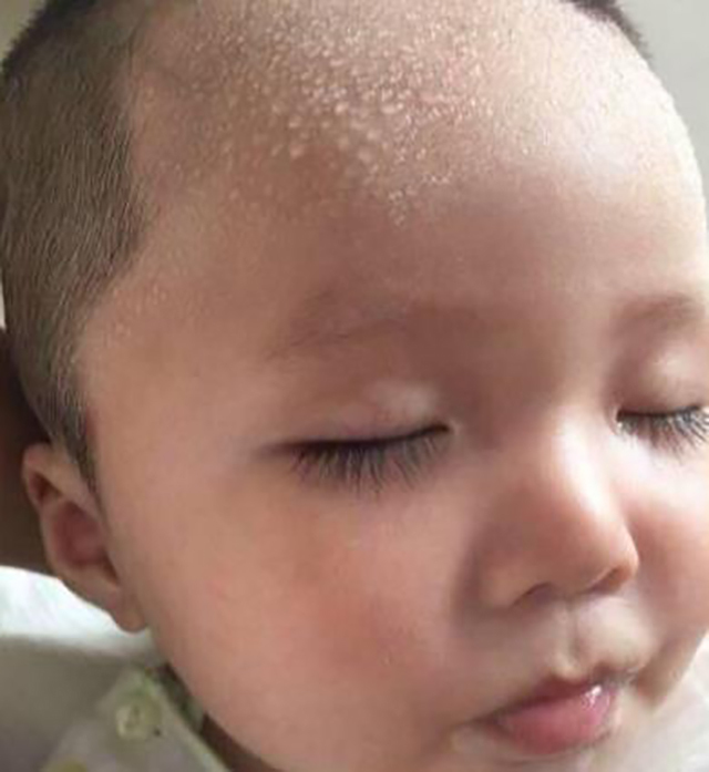 排毒|出汗真能排毒减肥?认清这4个误区,不让汗水白流!