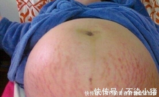 孕妇|42岁高龄孕妇剖腹产6胞胎，看着孩子们性别，产科医生都惊讶了