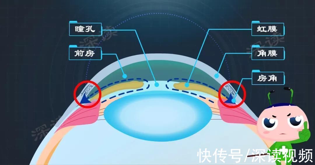 晶状体|玩手机玩出青光眼？生气气出青光眼？这些小事搞出青光眼