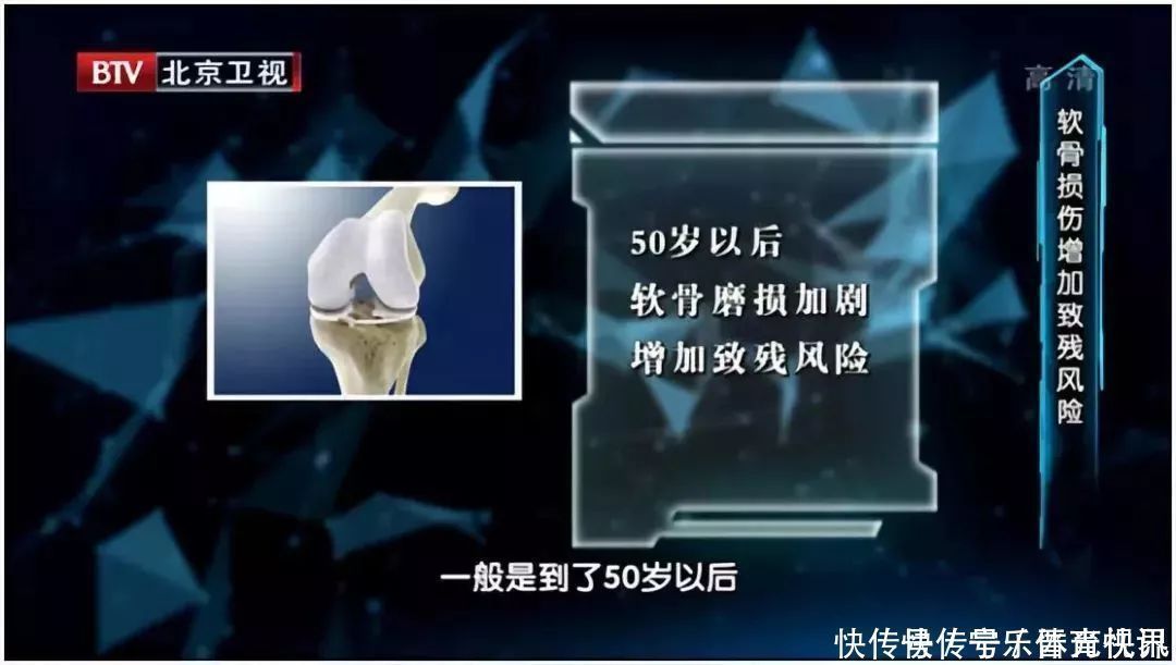 膝盖|夫妻双双手术换掉膝盖！罪魁祸首竟是坚持10年的“好习惯”！