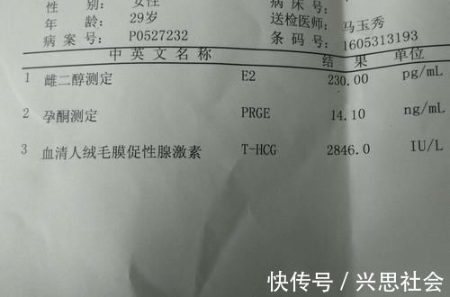 胎儿|刚怀孕,第一次孕检别盲目,只要这3项指标正常,胎儿就是健康的