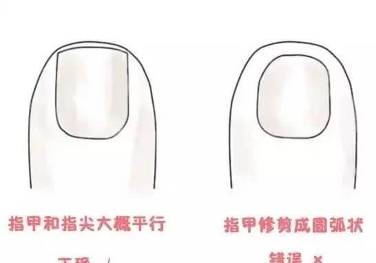 对策|超全15个新生儿常见问题及护理对策总结,新手爸妈速速收藏!