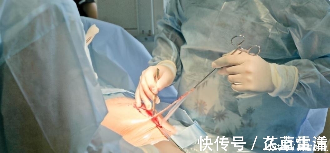 母则|剖腹产就是睡一觉那么简单?看看手术用的工具,就知啥叫为母则刚