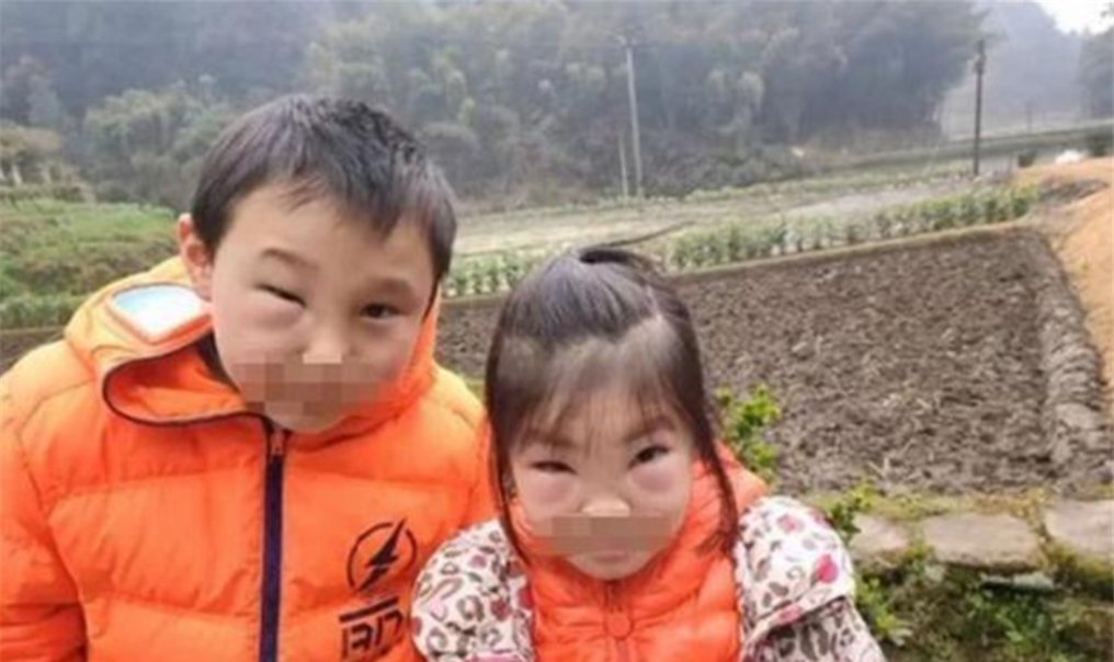 兄妹俩|“熊孩子”兄妹捅马蜂窝,蜇得爸妈认不出,网友不该笑但忍不住