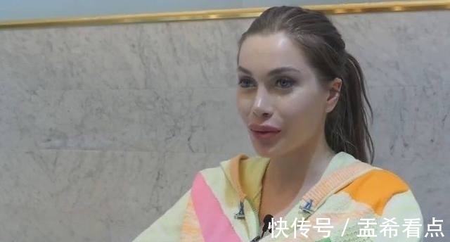整形手术 美国一女子去韩国做危险极高的额骨手术,还说整容上瘾