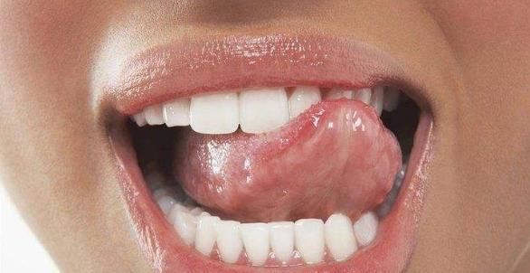 “嘴巴里”出现4种征兆,或是心脏“病”到晚期,赶快去医院检查