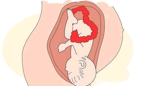 待产|准妈妈有这3种感觉,说明胎儿已经入盆了,应该要准备待产包了