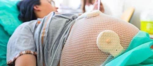 剖腹产|大学生妻子怀孕11个月还不生,医生强行剖腹产,娃出生后全家痛哭