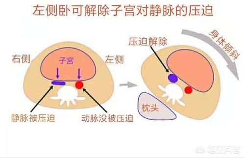 子宫|妊娠期间，孕妇的哪些行为会让胎儿很“抓狂”，有什么不良影响？