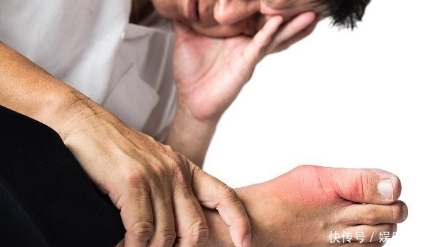 尿酸|尿酸的“克星”找到了,每天坚持喝一点,或许“痛风”不再来