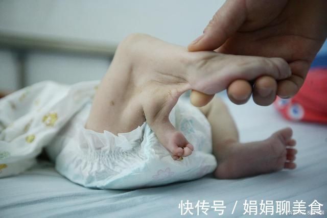 忌口|女子连生两胎畸形儿,在孕期有哪些食物是需要孕妈们忌口的