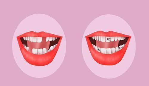 告诉|吃饭后漱口,对身体有哪些好处淡盐水漱口一定好告诉你真相