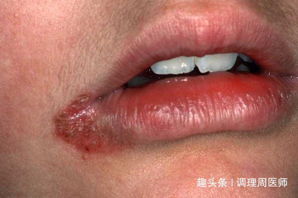 鹌鹑蛋|医生再次善意提醒鹌鹑蛋虽是“卵中佳品”,但这2类人最好别碰