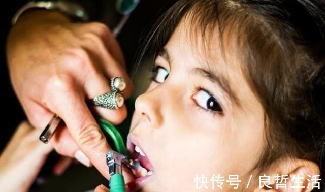 刷牙|10个5岁儿童中,7个有龋齿,罪魁祸首居然不是糖?