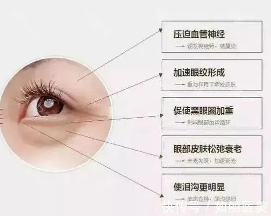 眼部抗衰