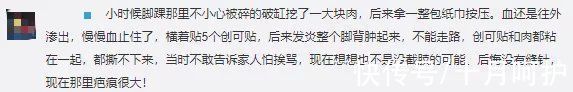 残疾|三岁女童被活活截断手指,终生残疾!只因用错创可贴,快自查