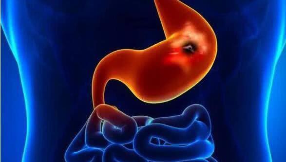 蜂蜜|胃病的“大救星”来了，每天吃一点，修复胃黏膜，远离胃病困扰！