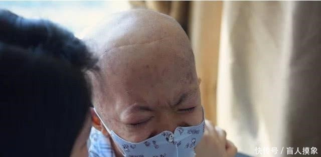 这东西|警惕两岁宝宝患上白血病!爸妈大哭这东西千万别让孩子碰!