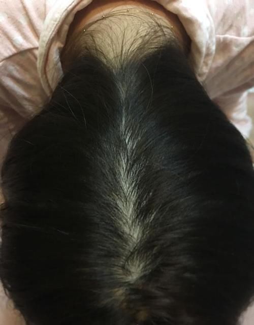 女生晚上睡觉,到底是该扎着头发还是散着头发?