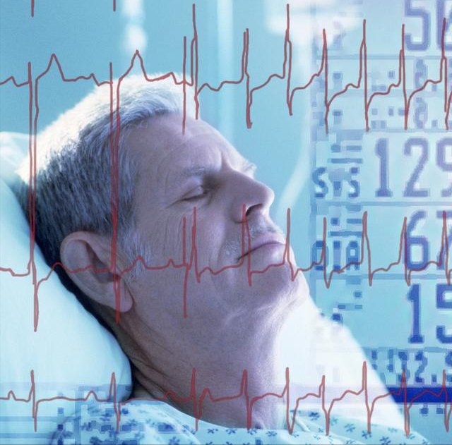 教科书|心率不到60次的注意了:你的心脏没毛病了