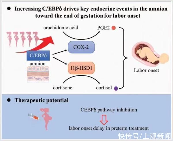 胎膜|引发早产的关键靶点被找到！仁济医院最新成果或为早产防治提供新策略