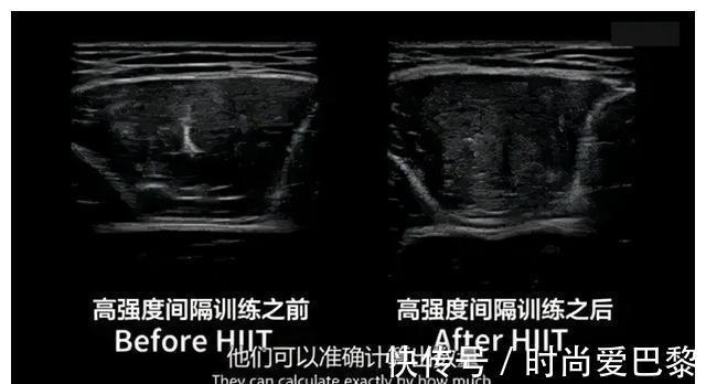 锻炼|BBC扎心实验:每天跑步45分钟,竟不如每周锻炼2