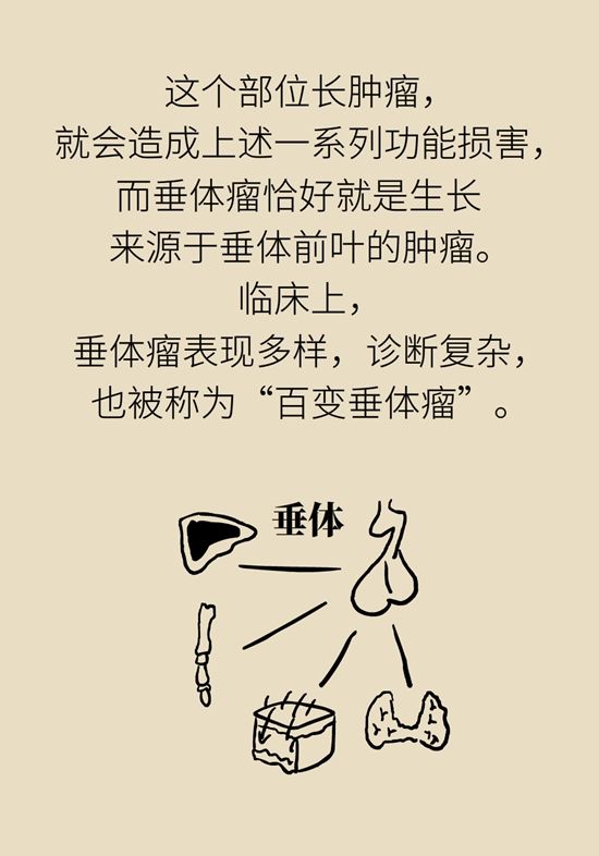 内分泌失调|变丑、变胖、内分泌失调……这些糟心事警惕脑肿瘤