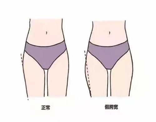 胯宽屁股大不用怕！掌握这5个穿搭技巧，身材走形也没关系